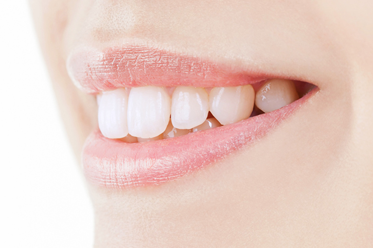 白く輝く歯を実現するホワイトニング