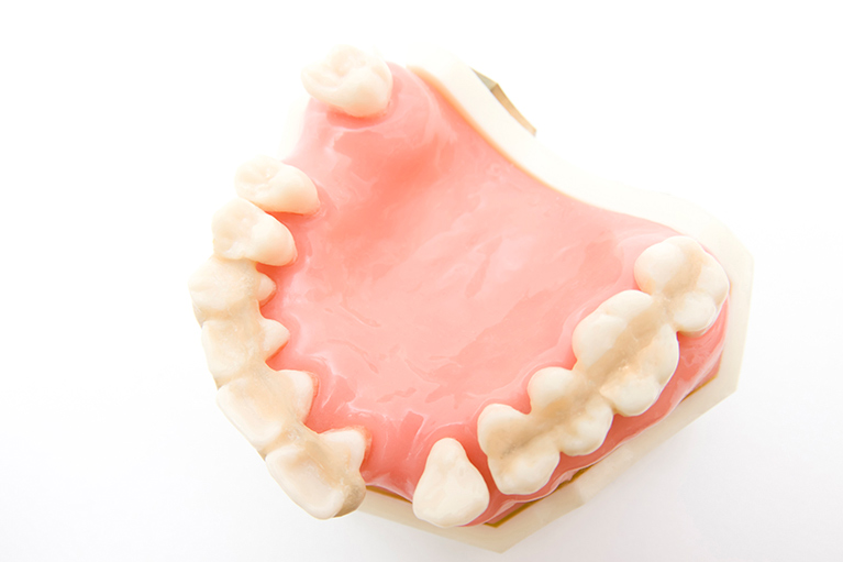 歯周病検査の重要性